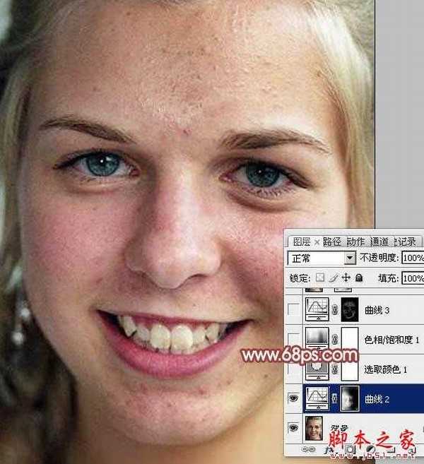 photoshop利用通道为满脸痘痘人物磨皮教程